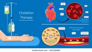 Iron Infusion Side Effects