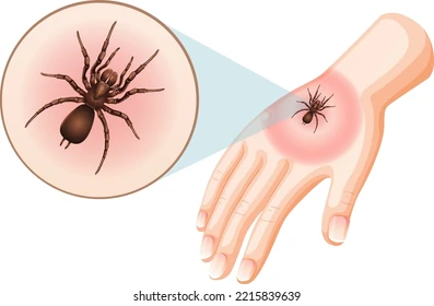 Spider Bite Side Effects