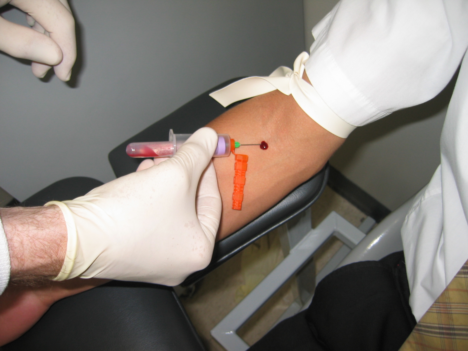 Getting Blood Drawn Side Effects