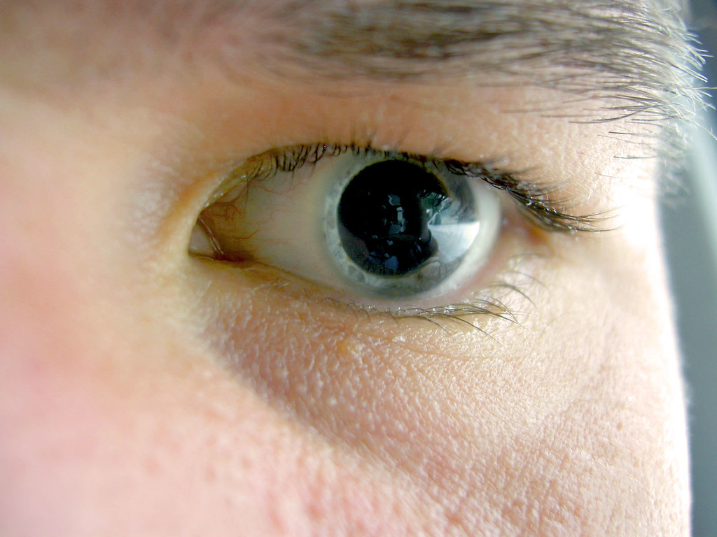 Major side effects ​of ‍Dilating Eye Drops