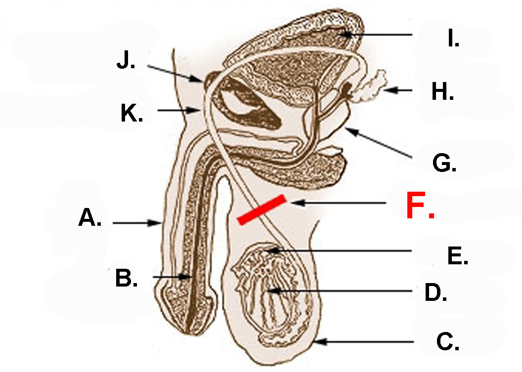 Managing Libido Changes post Vasectomy