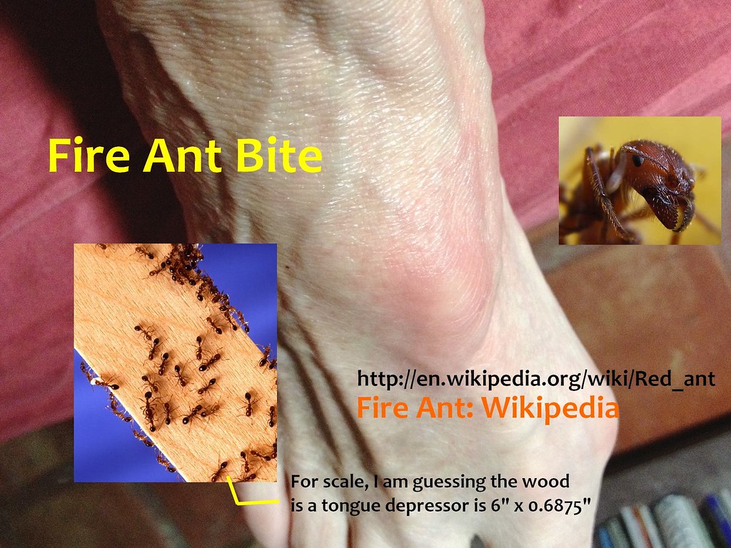 Side Effects Of Fire Ant Bites