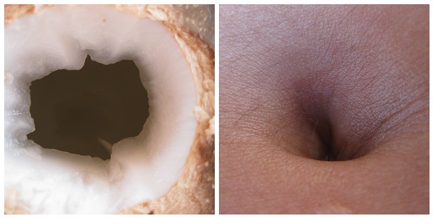 Coconut Oil In Belly Button Side Effects