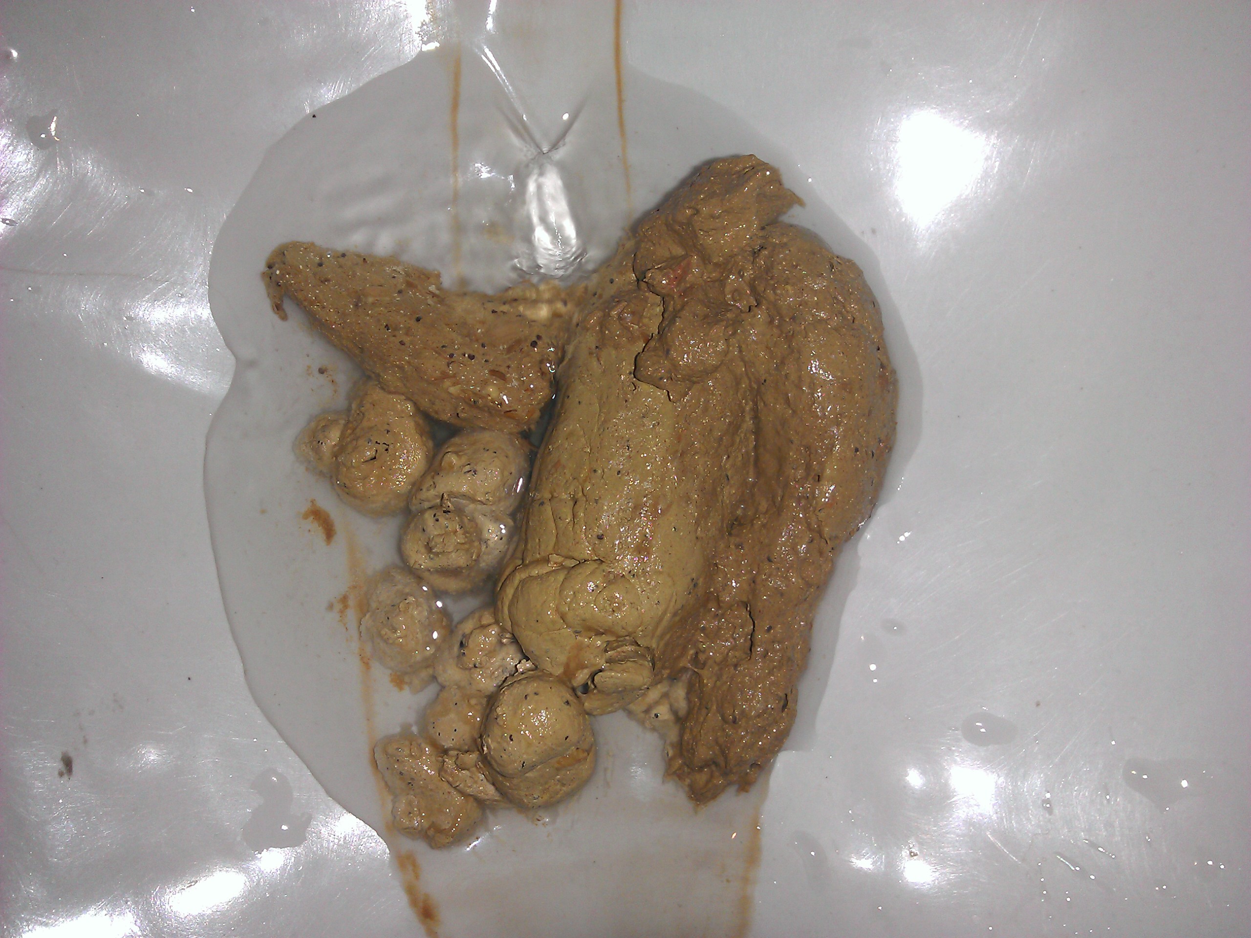 - Major side effects of consuming human feces
