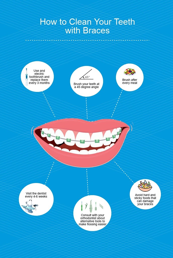 - Major Side Effects ⁤Caused by Wearing Braces Too Long